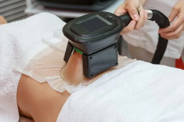 Image of person having fat freezing treatment to help weight gain Newark on Trent