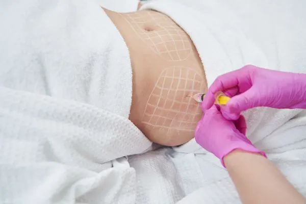 image of fat dissolving injections on love handles to help combat weight gain Newark on Trent