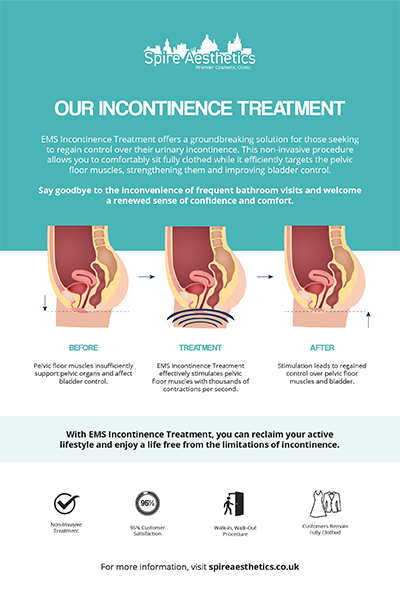 image of how urge incontinence Newark on Trent treatment works