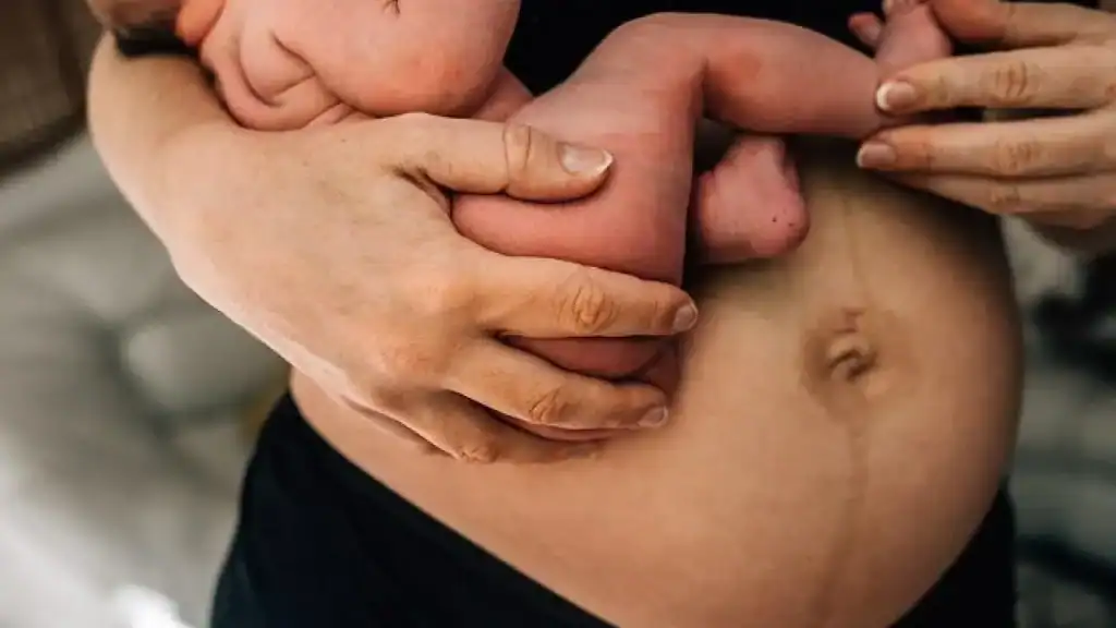 Why Is My Stomach Still Big After Pregnancy Newark on Trent?